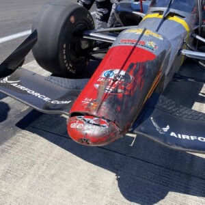 Conor Daly's nose after the 2021 Indianapolis 500